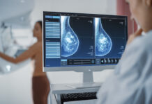 L’IA affianca i radiologi nella lettura delle mammografie