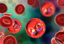 Malaria: la variante dell’emoglobina è associata ai ceppi del parassita presenti nelle infezioni senza sintomi