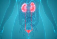 Tumore della vescica, l’RNA nelle urine potrebbe orientare diagnosi e terapie